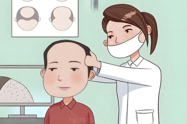 植发价格表一览表2025:FUE/微针/不剃发植发新费用明细+20个必知问题全解析