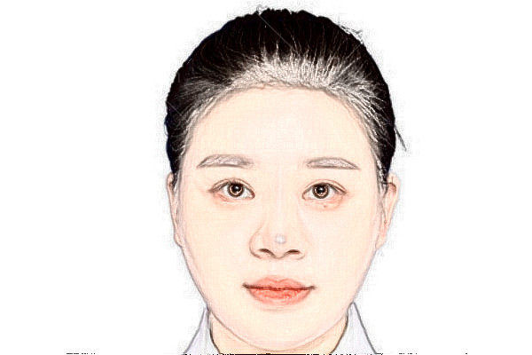 淮北爱尔眼科医院冯鑫医生