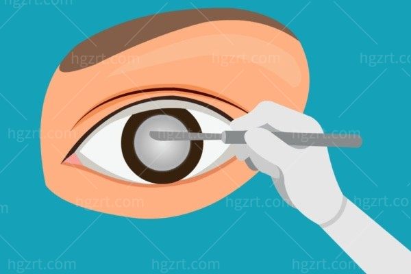 白内障手术可以同时矫正近视和老花眼是真的吗