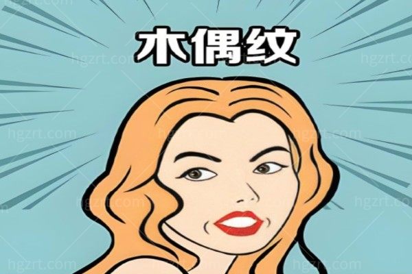 木偶纹怎么消除成效好？
