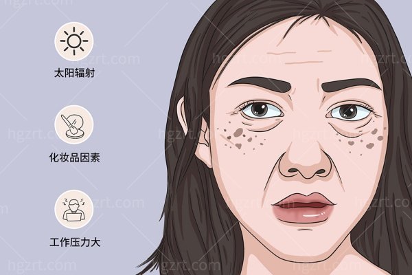 郑州去老年斑医院哪家强？认准这几家技术好又正规的医院！