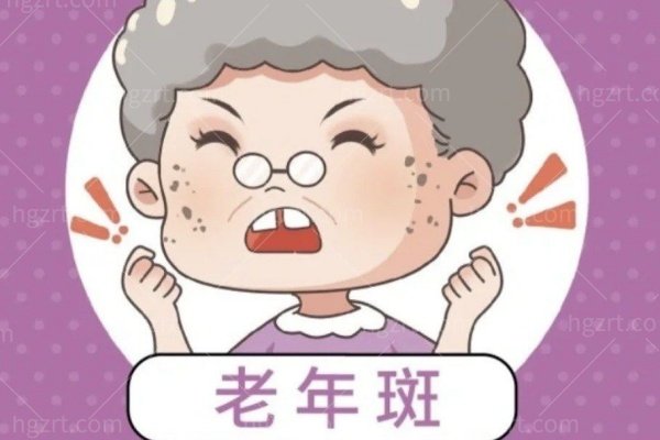 郑州祛斑医院排名哪家好