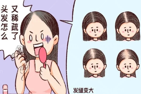 纹发际线的后悔了