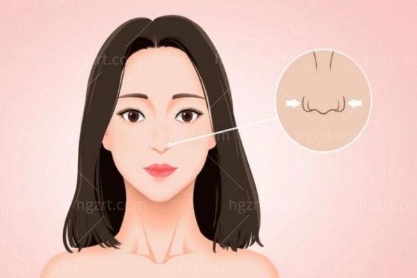 金华时光整形医院隆鼻贵吗