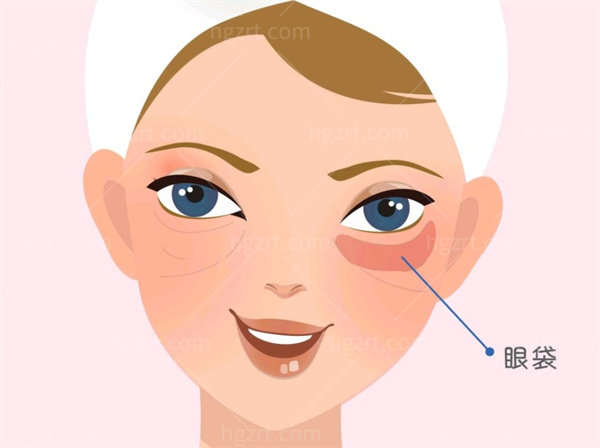 唐山释妍整形医院祛眼袋收费贵吗