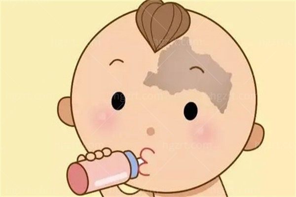 广州去胎记哪里好？广州曙光医院去胎记真实体验大揭秘！