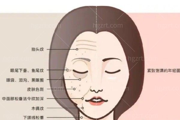 做面部提拉会使皮肤越来越松弛吗？