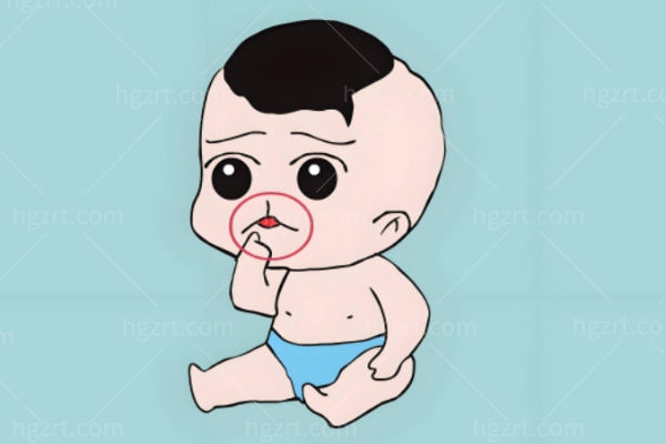 广州丽合肖强做唇裂多少钱