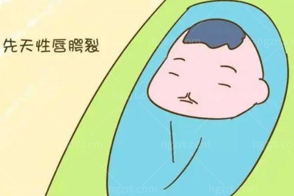 上海海华医院安洪宾做唇裂手术价格表