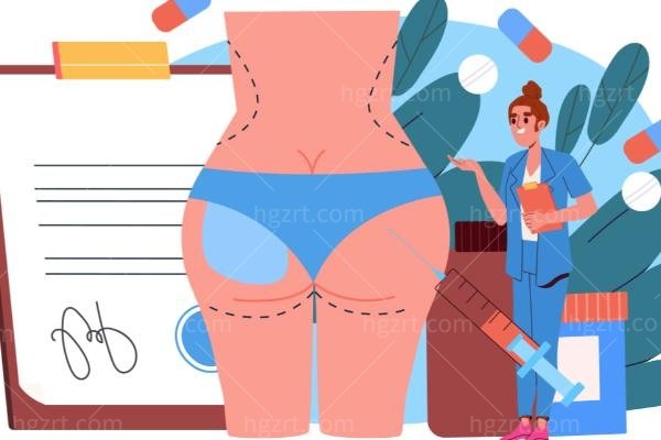 深圳福雅做丰臀好不好