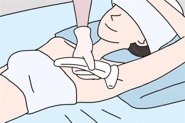 西安激光脱毛哪家好