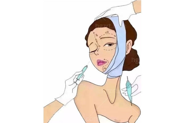 杭州艺星李俊霞医生好不好