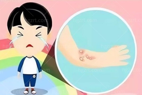 上海疤痕科排名前十的大医院盘点：疤痕修复技术好附正规医院推荐