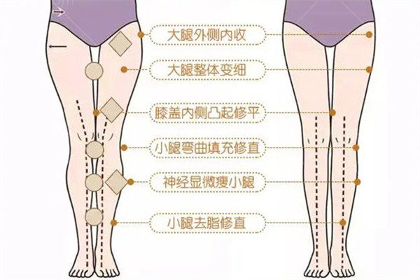 西安西美整形医院直腿价格表
