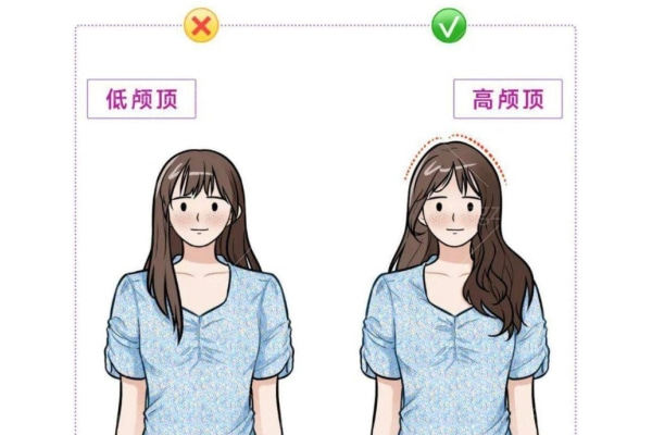 什么是骨水泥填充颅顶