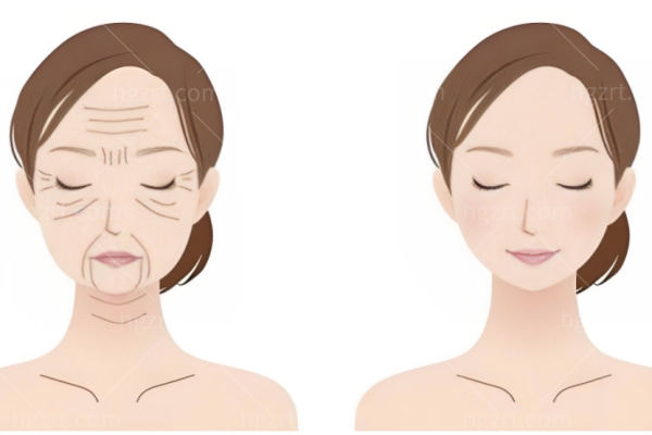 北京和王明利医生哪位做脂肪填充好?2026年医生选择指南