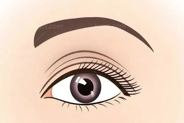 郑小红双眼皮修复13000元起真不贵！为什么说这个价格很值？