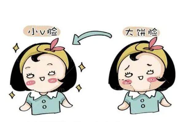 重庆松山肖林做下颌角