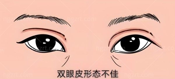 北京双眼皮修复医生谁的价格便宜点