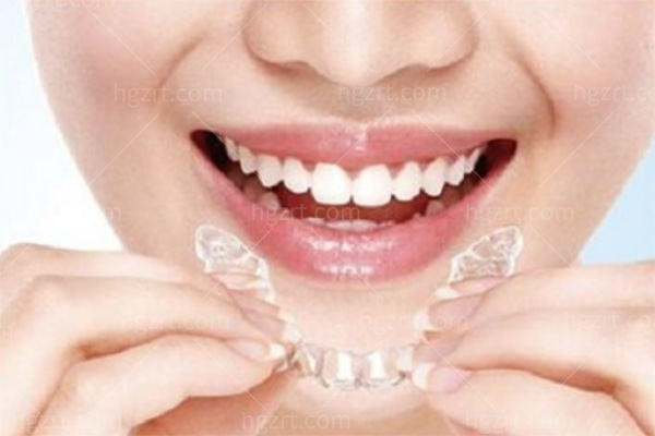 日本拓美陶瓷自锁托槽好不好