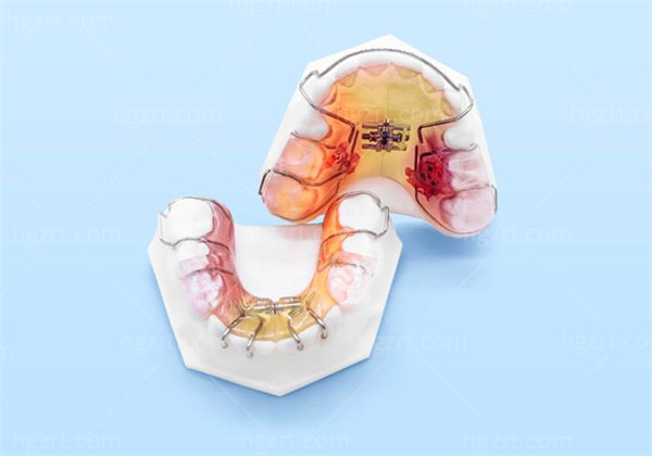 JPF矫治器与MRC矫治器