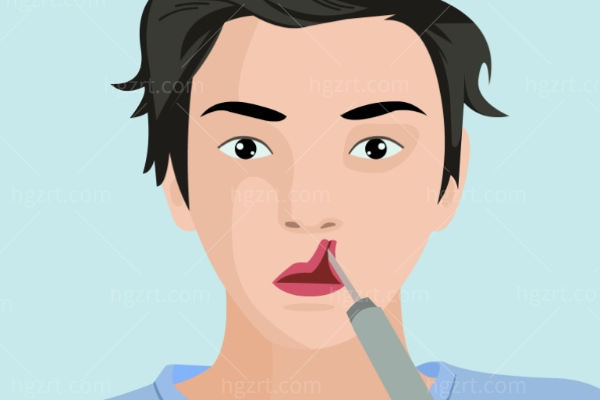 上海做唇裂修复好的医美医院推荐