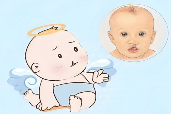 上海做唇裂修复好的医美医院推荐