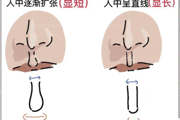 北京做人中缩短排名靠前的医院