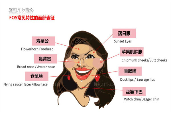 北京俊泰美好做馒化脸怎么样?减容+收紧当天完成改善技术和口碑挺不错