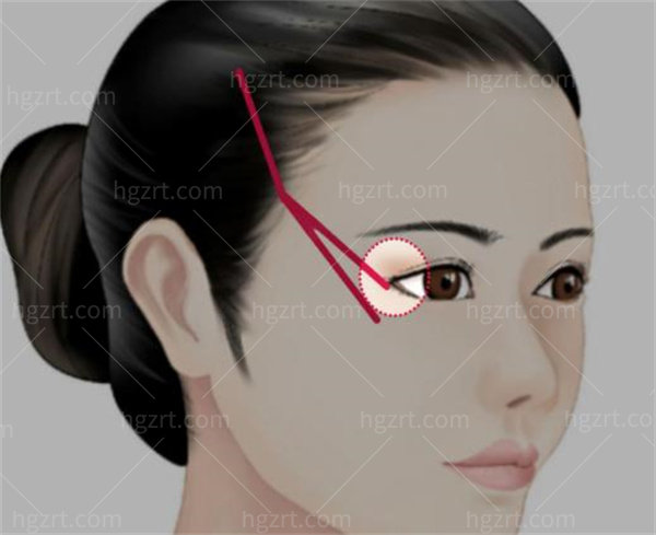 成都素美是正规整形医院吗？从资质/医生/口碑/收费等方面一文解析