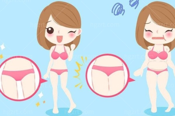 冯斌吸脂做得好吗？为什么贵？