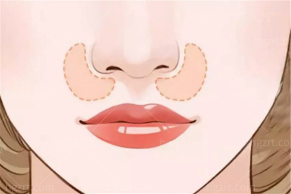 朱刚强鼻子做得怎么样