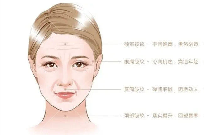 全脸拉皮手术