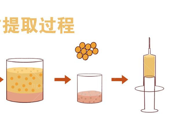 北京王明利吸脂怎么样