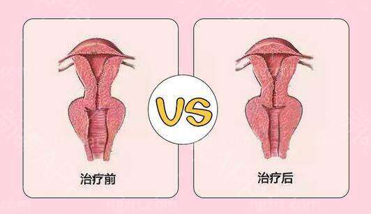 紧缩针预约怎么网上预约?快速get24h紧缩针预约挂号指南及在哪里可以打