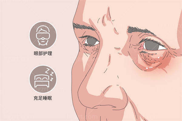 淄博哪家医院祛眼袋好？淄博眼袋的手术与淄博正规的整形医院全解析