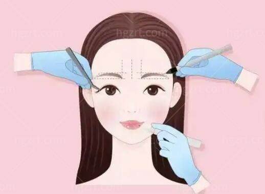 南京汪树杰双眼皮修复怎么样?专解眼睑外翻/疤痕增生等,10年显微精修数千例病例