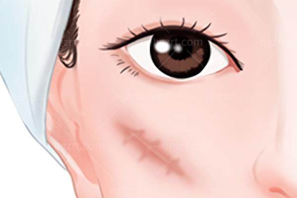 疤痕疙瘩有必要治吗