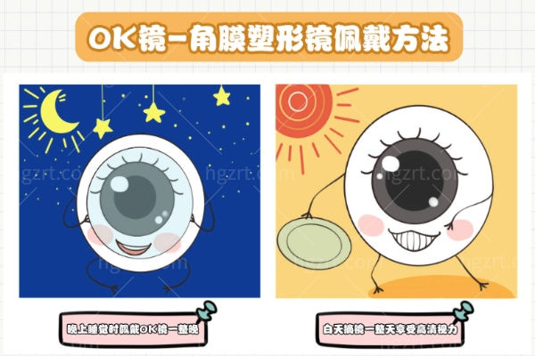 上海角膜塑形镜价格大揭秘
