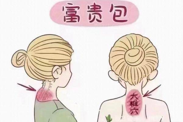 重庆做富贵包哪家医院好