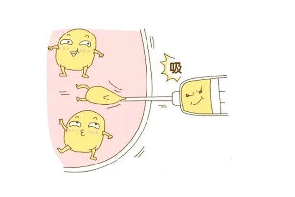在沈阳做抽脂到底要准备多少钱