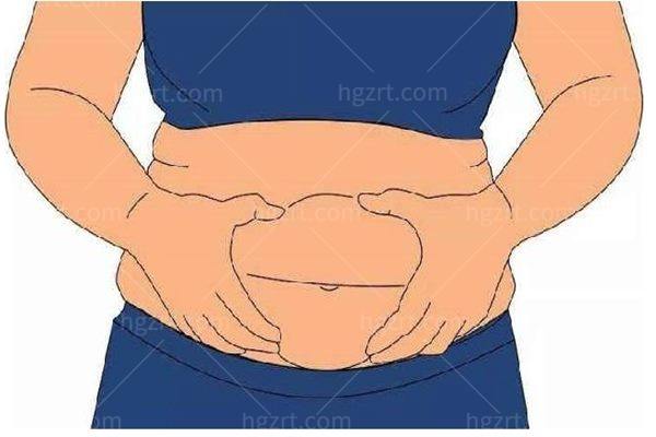 腰腹吸脂