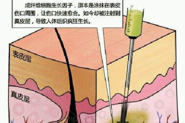 国内不明异物取出哪家医院好？北京/南京/广州等地正规医院整理