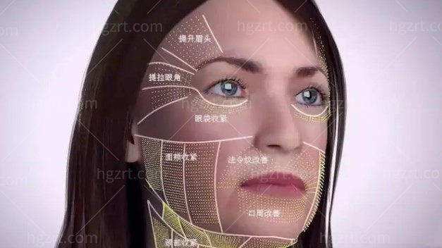 暖男崔钟赫院长亲诊！美版超声刀二代（Ulthera）火热来袭，体验价仅109万韩币起！
