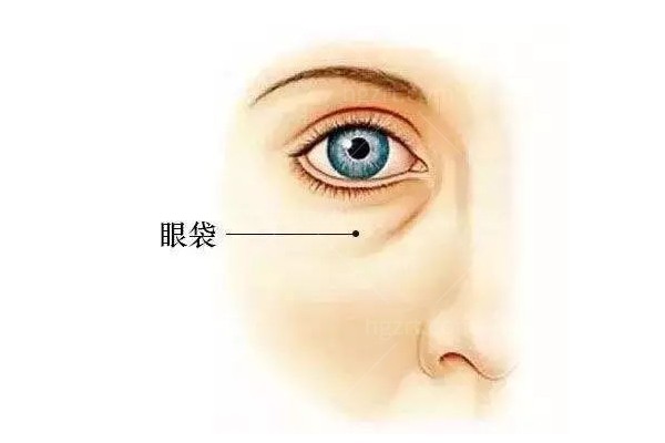 健丽医美做眼袋可靠吗？