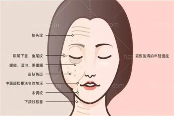 解永学韧带提升多少钱