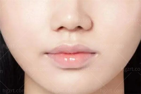 上唇疤痕挛缩怎么办？