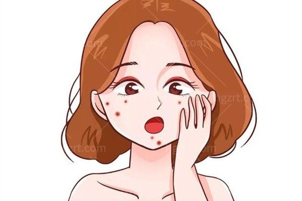 老是在痘印处反复起痘，怎么办？