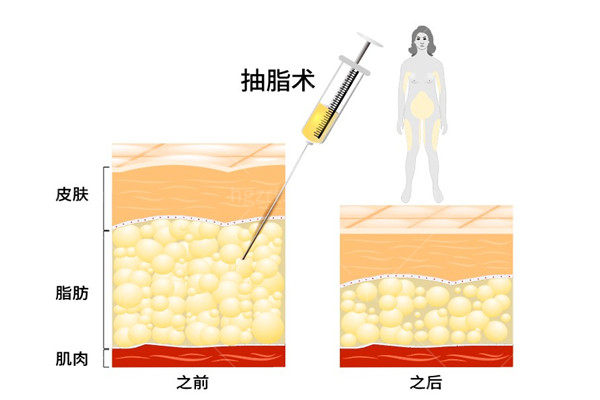韩国美尔韩医院好不好