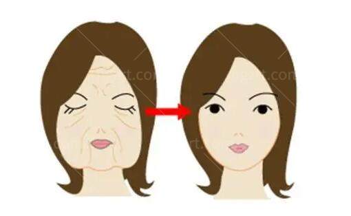 北京李晓东医生是在黄寺医院坐诊,PSV 高位提升专攻中重度松弛,20年经验+数千例病例 北京李晓东医生是在黄寺医院坐诊,PSV 高位提升专攻中重度松弛,20年经验+数千例病例